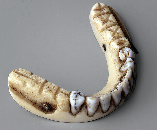 Zahnprothese, sogenannte „Waterloo-Zähne“, nach 1815. Bevor Porzellan als Zahnersatz gebräuchlich wurde, fanden menschliche Zähne für Prothesen Verwendung. Leichenfledderer brachen den Gefallenen Zähne heraus und verkauften sie an Zahnärzte als Zahnersatz. (Inv.Nr. AK 97/76)