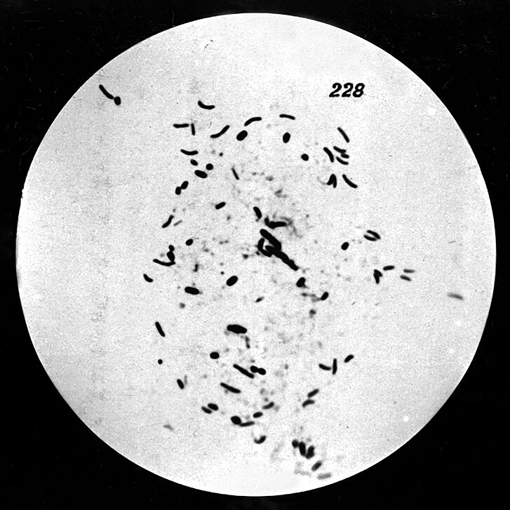 Mikroskopische Aufnahme von Vibrio Cholerae Mikroskopische Aufnahme von Vibrio Cholerae in schwarz weiß