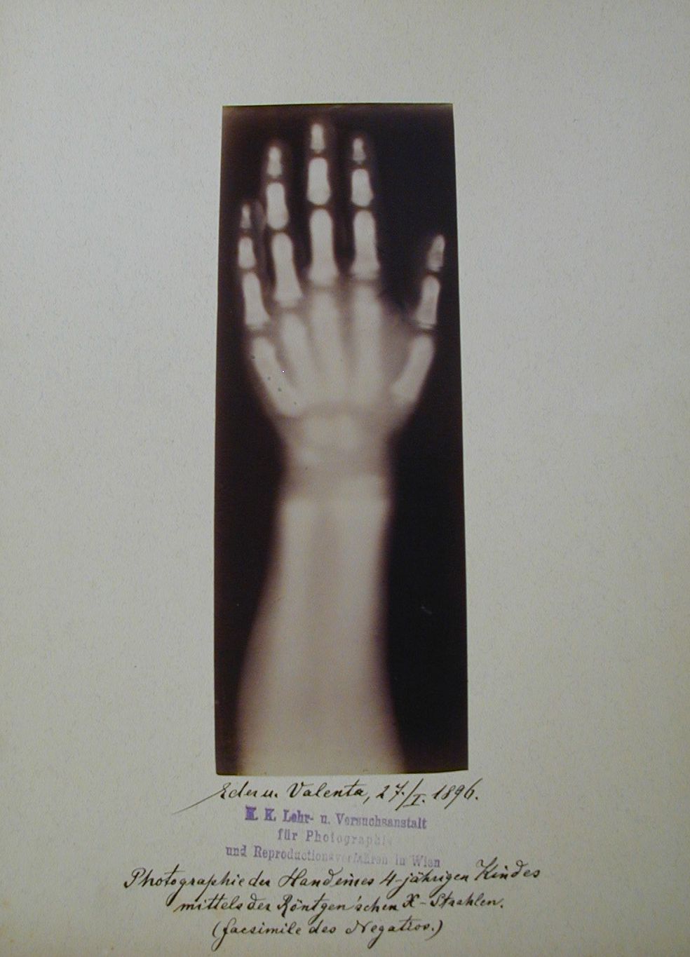 [Röntgenaufnahme, 1896]
